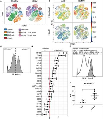 HLA Upregulation During Dengue Virus Infection Suppresses the Natural Killer Cell Response